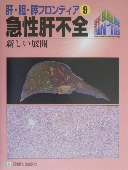 【中古】急性肝不全 新しい展開/診断と治療社/沖田極（大型本）