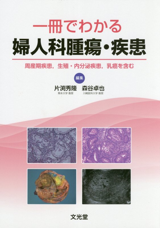 【中古】一冊でわかる婦人科腫瘍・疾患 周産期疾患，生殖・内分泌疾患，乳癌を含む /文光堂/片渕秀隆（単行本）