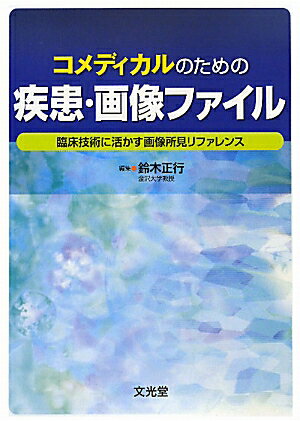 【中古】コメディカルのための疾患・画像ファイル 臨床技術に活かす画像所見リファレンス /文光堂/鈴木正行（単行本）