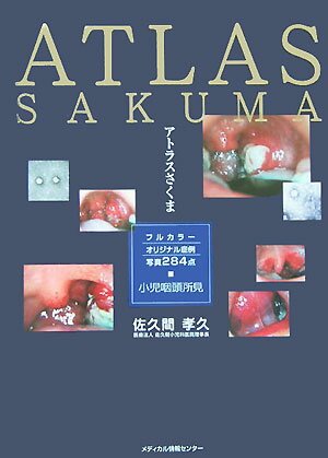 楽天市場】アトラスさくま 小児咽頭所見の通販