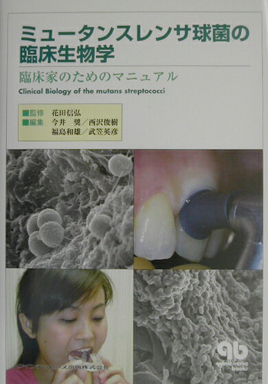 Dentistry - 【中古】ミュ-タンスレンサ球菌の臨床生物学 臨床家のためのマニュアル /クインテッセンス出版/今井奨（単行本）