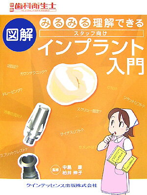 【中古】みるみる理解できる図解スタッフ向けインプラント入門 /クインテッセンス出版/中島康（単行本）