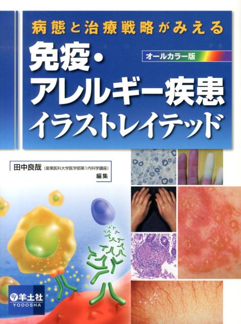 【中古】免疫・アレルギ-疾患イラストレイテッド 病態と治療戦略がみえる/羊土社/田中良哉（単行本）