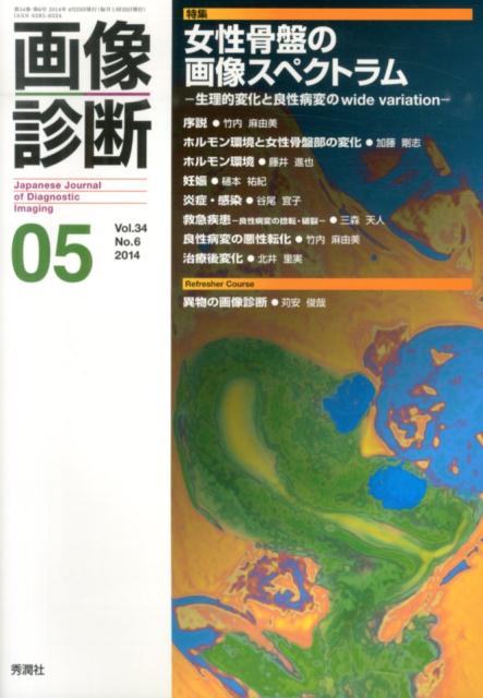 Medicine - 【中古】画像診断　14年5月号 34-6/学研メディカル秀潤社（単行本）