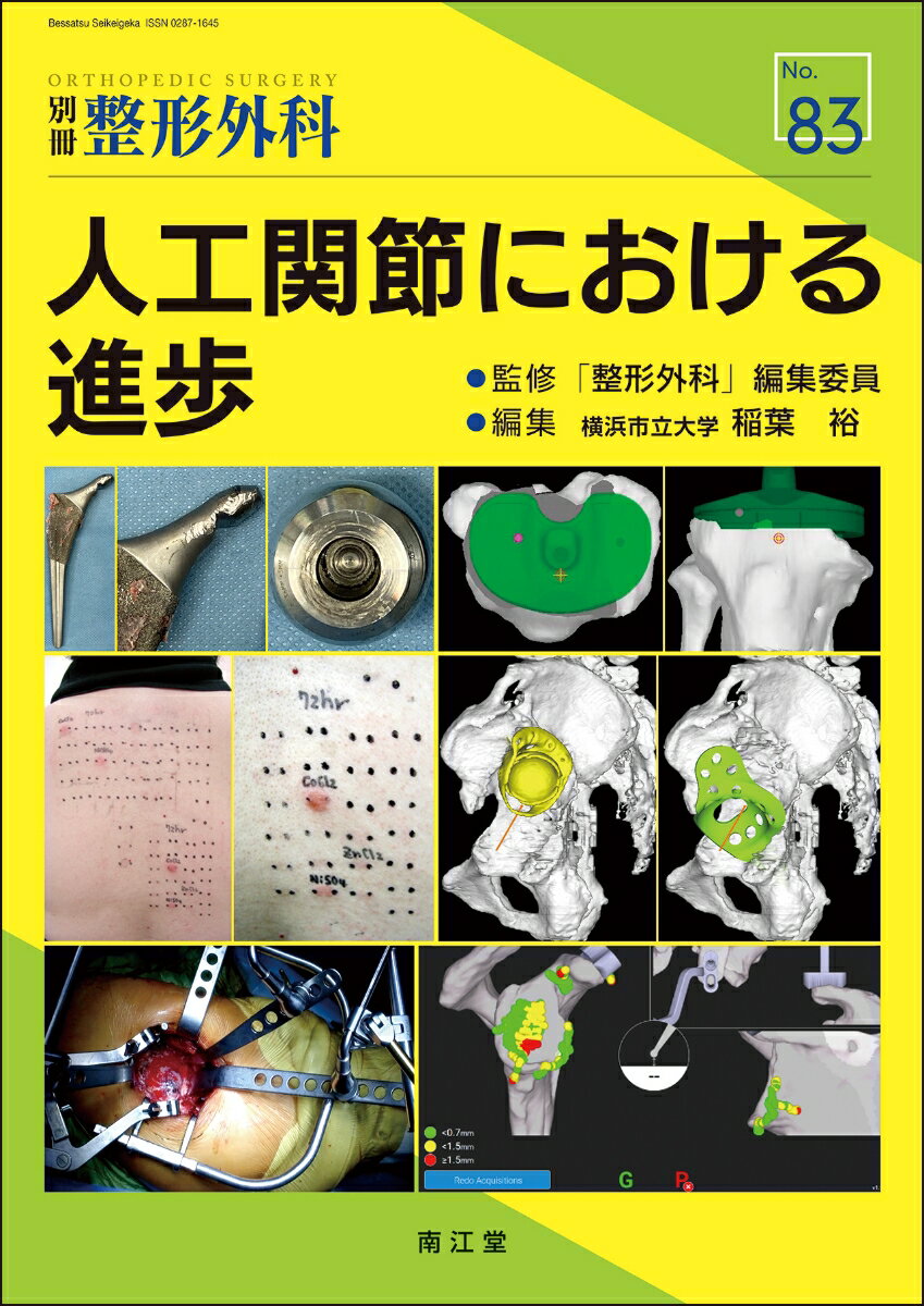 【中古】人工関節における進歩/南江堂/稲葉裕（整形外科）（大型本）