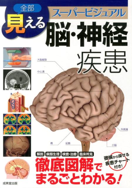 楽天市場】全部見える整形外科疾患 スーパービジュアルの通販
