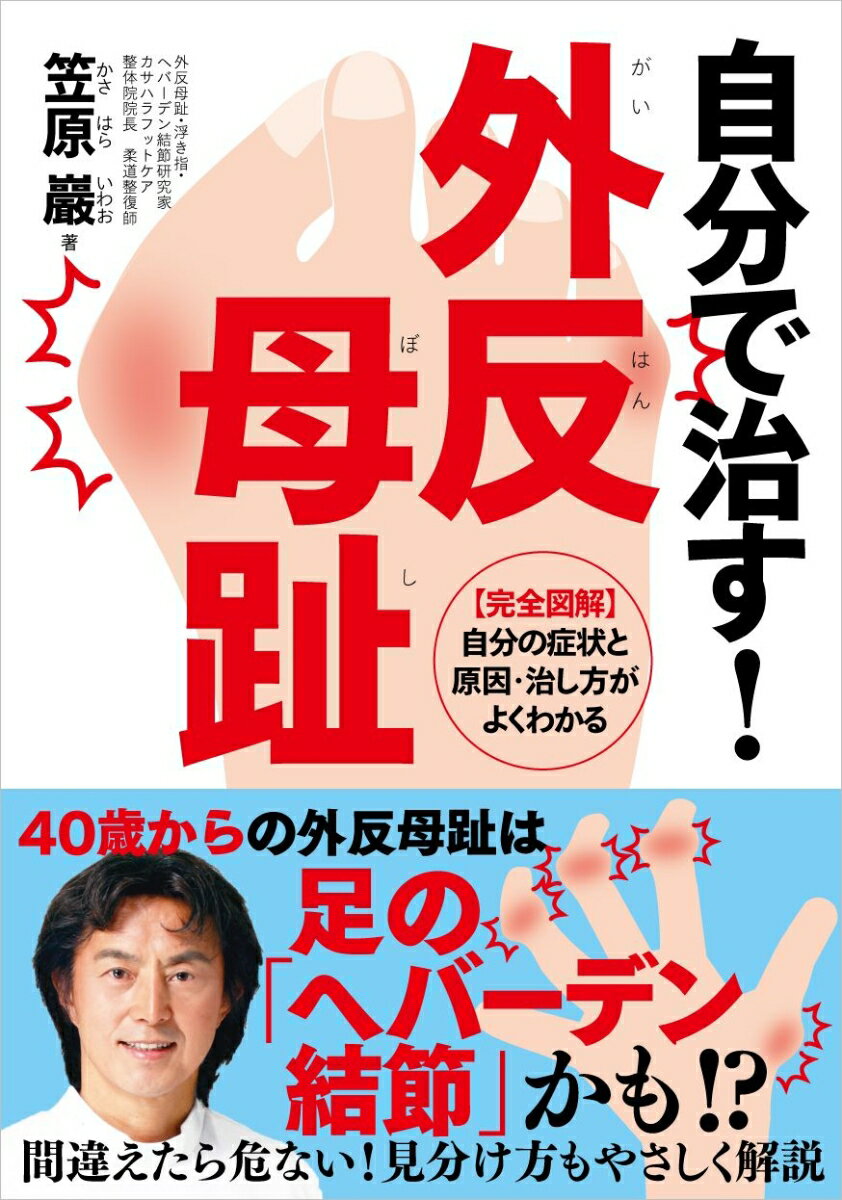 【中古】自分で治す！外反母趾/自由国民社/笠原巖（単行本）