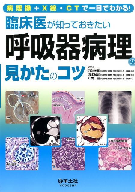 楽天市場】ctパターンから理解する呼吸器疾患 所見×患者情報から導く