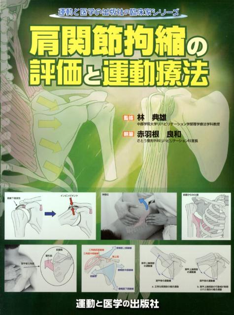 【中古】肩関節拘縮の評価と運動療法/運動と医学の出版社/赤羽根良和（単行本（ソフトカバー））