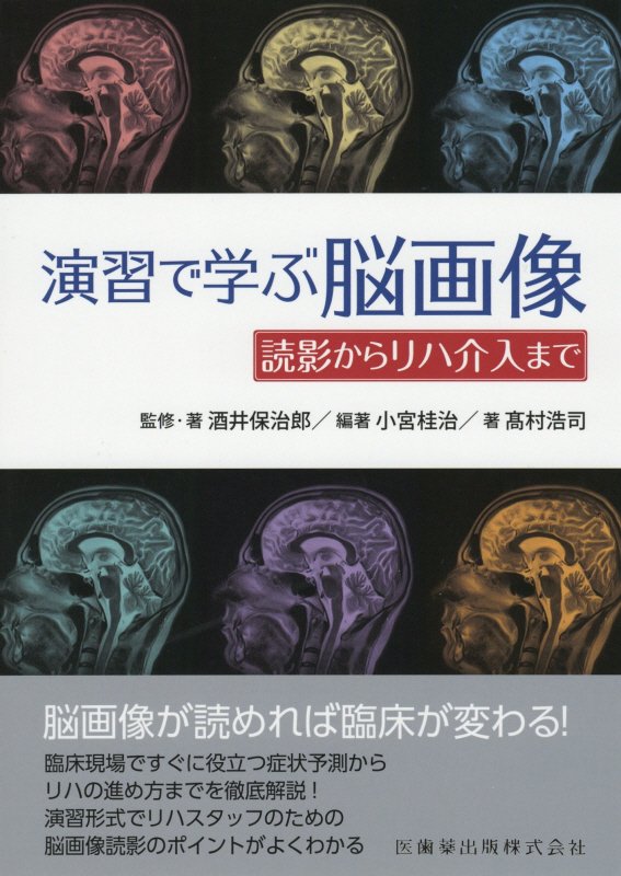 【中古】演習で学ぶ脳画像 読影からリハ介入まで/医歯薬出版/酒井保治郎（単行本（ソフトカバー））