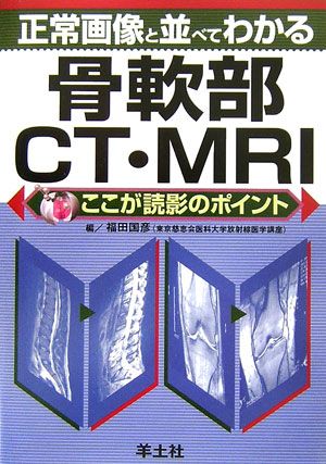 【中古】正常画像と並べてわかる骨軟部CT・MRI ここが読影のポイント/羊土社/福田国彦（文庫）