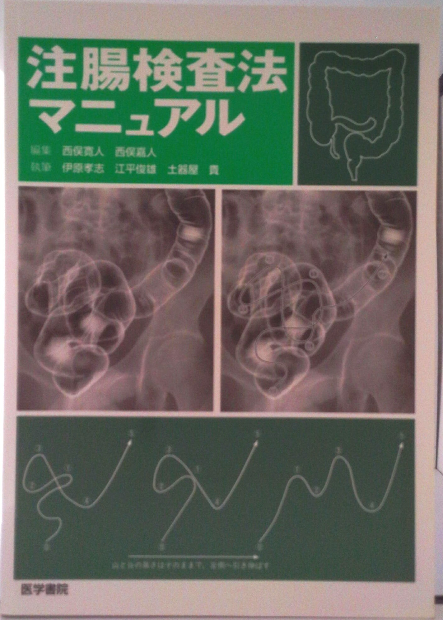 【中古】注腸検査法マニュアル/医学書院/西俣寛人（単行本）