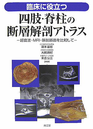 【中古】臨床に役立つ四肢・脊柱の断層解剖アトラス 超音波・MRI・解剖断面を比較して/南江堂/瀬本喜啓（大型本）
