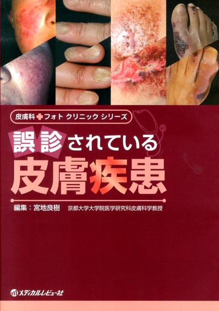 【中古】誤診されている皮膚疾患/メディカルレビュ-社/宮地良樹（単行本）