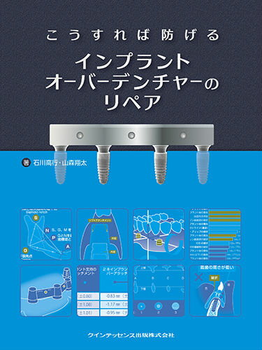 【中古】こうすれば防げるインプラントオ-バ-デンチャ-のリペア/クインテッセンス出版/石川高行（単行..