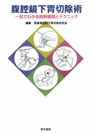 楽天市場】令和スタイル鏡視下胃手術のすべての通販