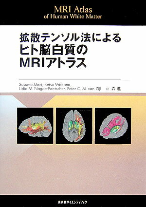 【中古】拡散テンソル法によるヒト脳白質のMRIアトラス（大型本）