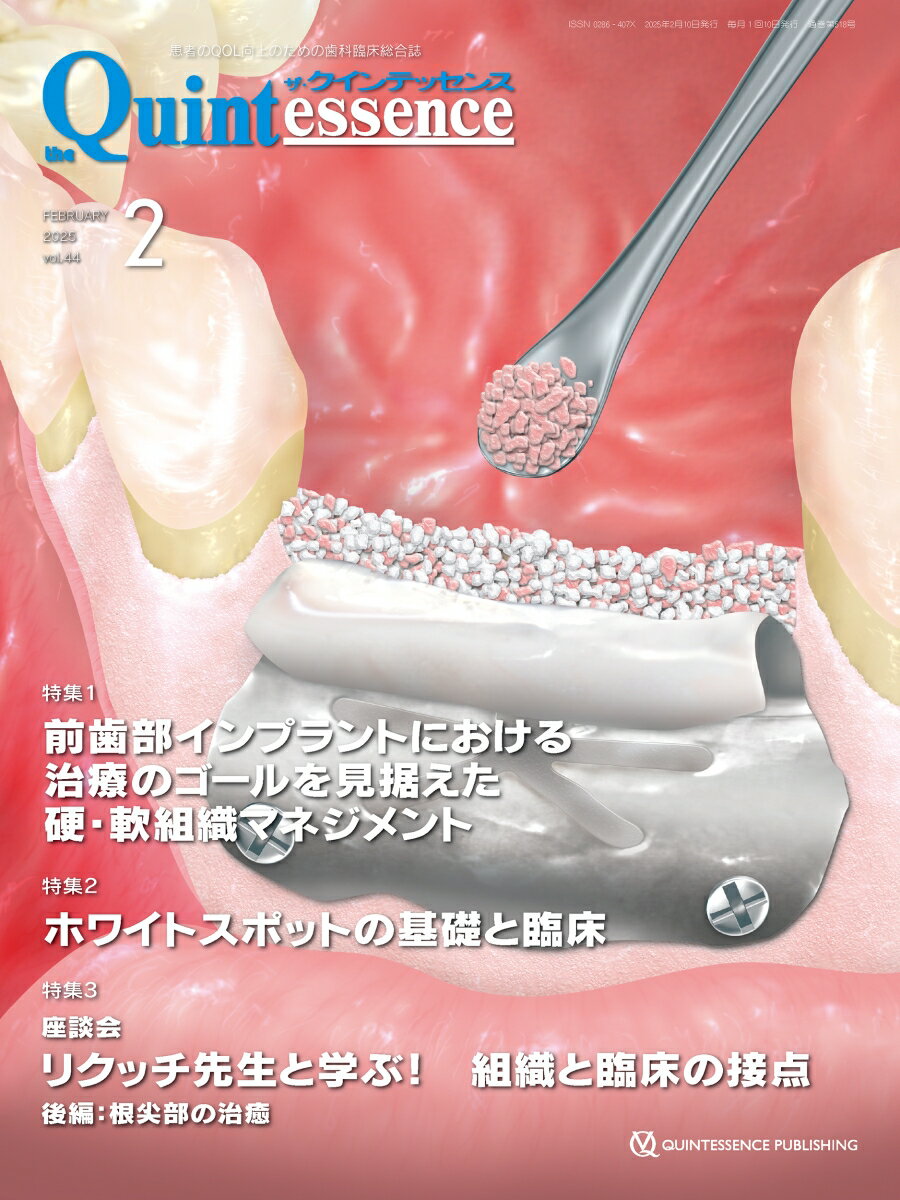 ◆◆◆非常にきれいな状態です。中古商品のため使用感等ある場合がございますが、品質には十分注意して発送いたします。 【毎日発送】 商品状態 著者名 編集:クインテッセンス出版 出版社名 クインテッセンス出版 発売日 2025年02月 ISBN 9784781210483