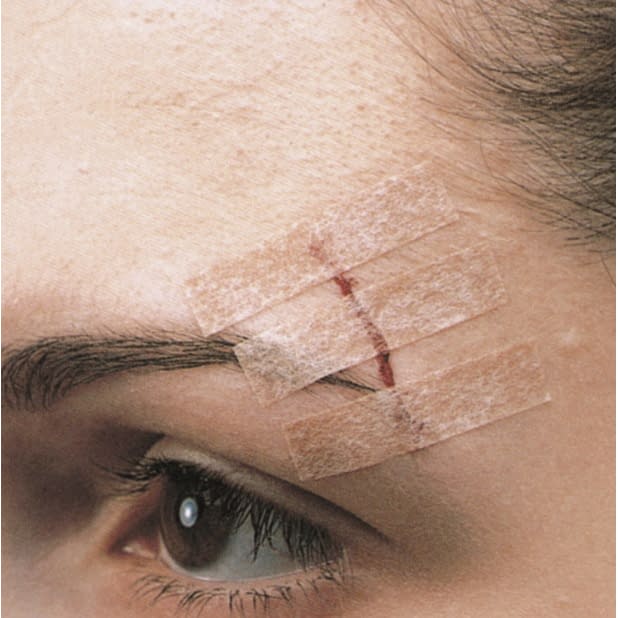 ステリストリップスキントーン（SP） B1551SP(6X75)3ホンX10フ 25310700 スリーエムジャパン