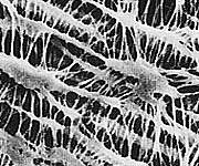 �ڴ��ָ���!�оݾ���P2��20�ܡ� ����˥ݥ�TM ���֥��(��ϡ����޷�ξ��) 10��m�ߦ�25mm 100���� JCWP02500 1Ȣ(100����)