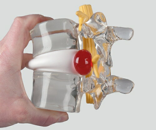 【期間限定!対象商品P2〜20倍】 ヘルニアモデル 190×160×140 4400 1個 3