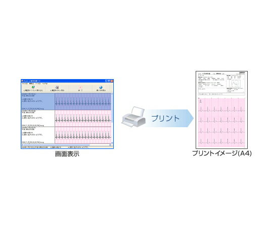 ŷ ſްե HCG-SOFT-2 1