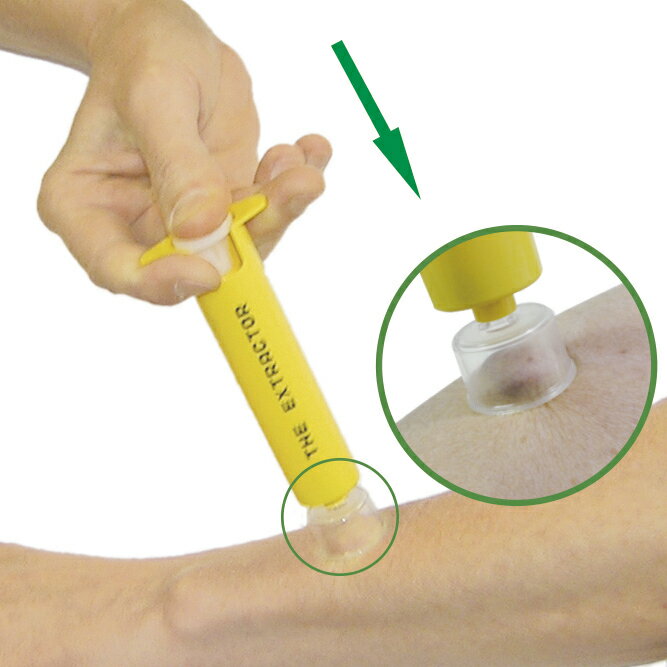 ポイズンリムーバー・エクストラ AP-011(1コイリ)