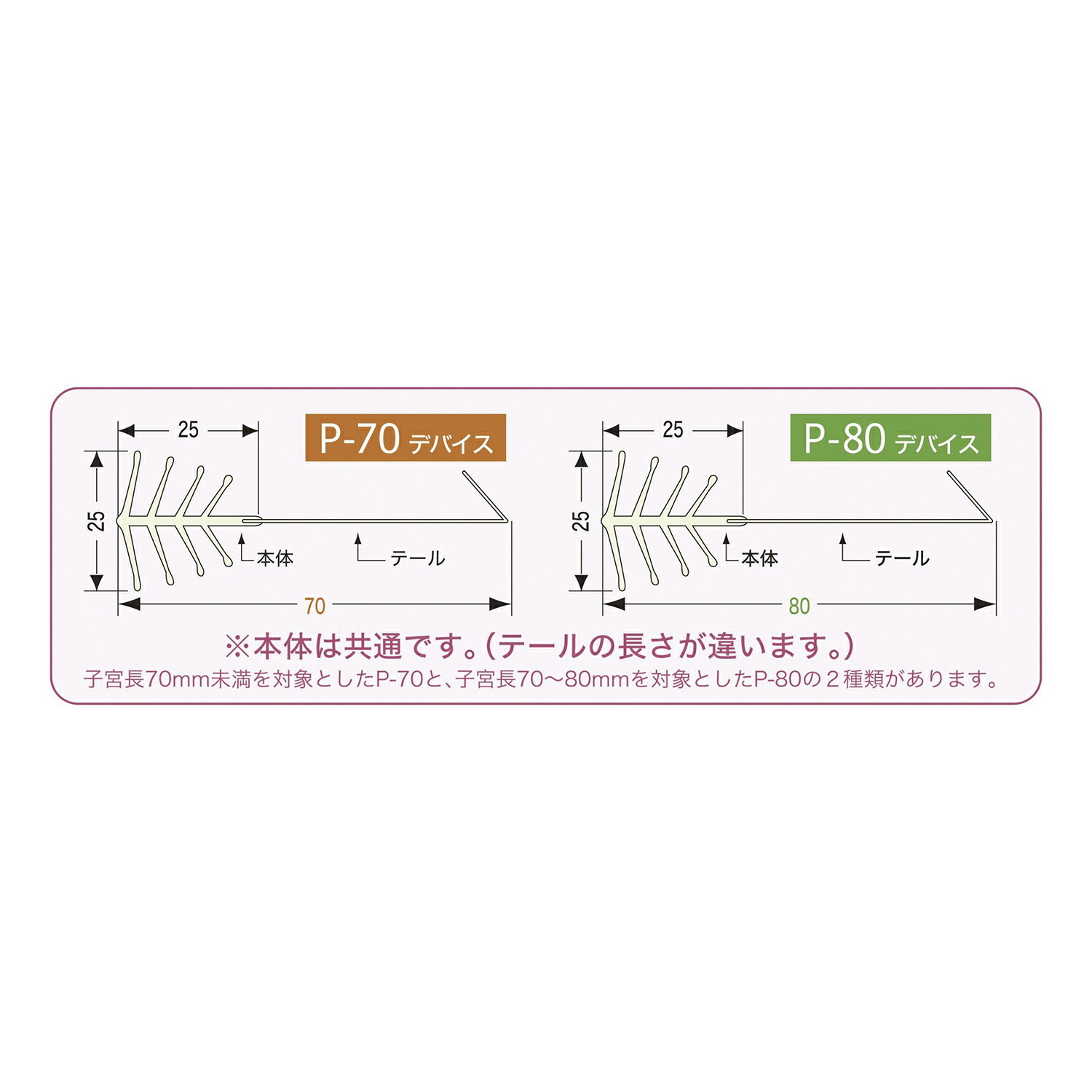 子宮内避妊用具　FD−1 P-80(80MM)3ポンイリ