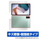 Xiaomi Redmi Pad 表面 背面 フィルム OverLay Magic for シャオミー タブレット レドミ パッド 表面・背面セット 傷修復 耐指紋 指紋防止(2)