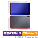 CHUWI HiPad Air 表面 背面 フィルム セット OverLay Plus Lite ツーウェイ ハイパッド エアー 高精細液晶対応 アンチグレア 反射防止(2)
