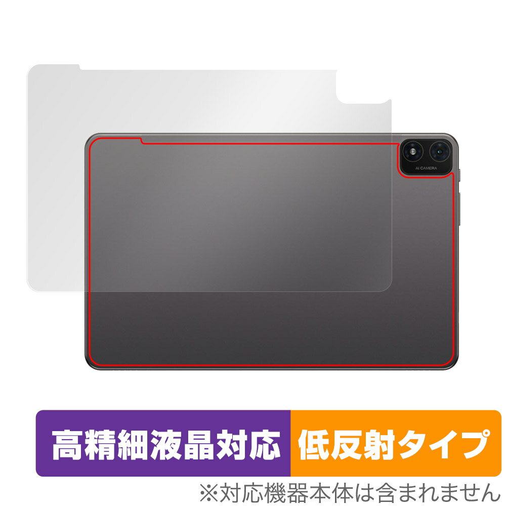Teclast T40S 후면 보호 필름 OverLay Plus Lite for 테크라스트 T40S 태블릿 본체 보호 필름 부드럽게 감촉 저반사 소재