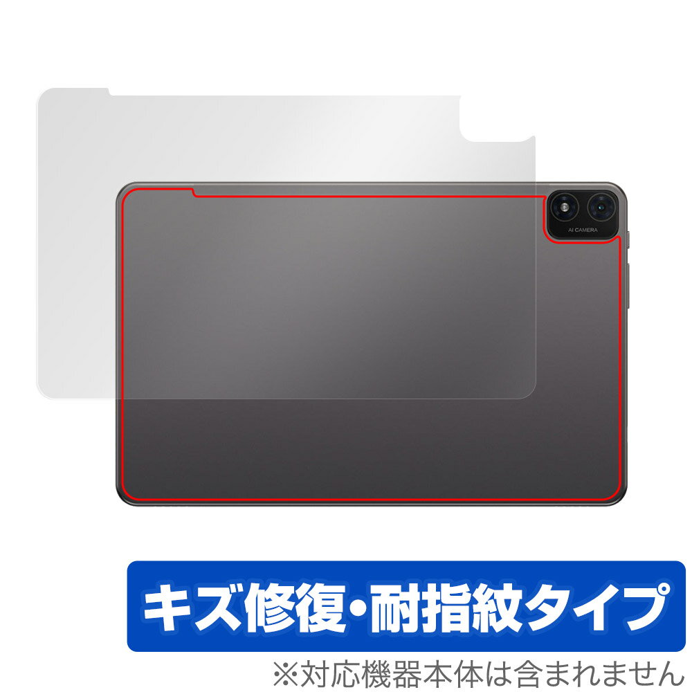 Teclast T40S 후면 보호 필름 OverLay Magic for 테크라스트 T40S 태블릿 본체 보호 필름 상처 수복 지문 방지 코팅
