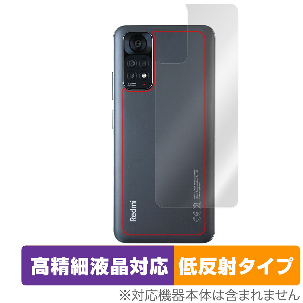 Xiaomi Redmi Note 11S / 11 w ی tB OverLay Plus Lite VI~[ X}z h~ m[g {̕ی 炳Gᔽˑf