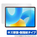 HUAWEI MatePad 11.5-inch 保護 フィルム OverLay Magic ファーウェイ メイトパッド 液晶保護 傷修復 耐指紋 指紋防止 コ...
