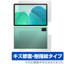 Teclast P40S 表面 背面 フィルム OverLay Magic for テクラスト タブレット 表面・背面セット 傷修復 耐指紋 指紋防止 コーティ...