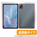 DOOGEE T20S 表面 背面 フィルム OverLay Plus ドゥージー T20S タブレット用保護フィルム 表面・背面セット アンチグレア 低反射(2)
