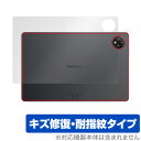 Blackview Tab 10 WiFi 背面 保護 フィルム OverLay Magic ブラックビュー タブレット用保護フィルム 本体保護 傷修復 指紋防止