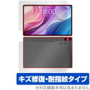 Teclast T40HD 表面 背面 フィルム OverLay Magic テクラスト タブレット用保護フィルム 表面・背面セット 傷修復 耐指紋 指紋防止(2)