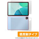 Blackview OSCAL Pad 18 表面 背面 セット 保護フィルム OverLay Plus ブラックビュー タブレット用保護フィルム アンチグレア 反射防止(2)