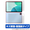 Blackview OSCAL Pad 18 表面 背面 セット 保護フィルム OverLay Magic ブラックビュー タブレット用フィルム 傷修復 指紋防...