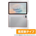 Velorim タブレット VIM100110 (MB1001) 表面 背面 セット 保護フィルム OverLay Plus タブレット用保護フィルム アンチグレア 低反射(2)