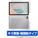 Velorim タブレット VIM100110 (MB1001) 表面 背面 フィルム OverLay Magic タブレット用保護フィルム 表面 背面セット 傷修復 指紋防止