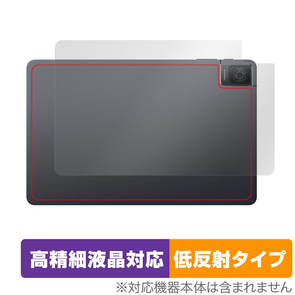 TCL TAB 10 Gen 2 8496G1 후면 보호 필름 OverLay Plus Lite for TCL 태블릿 본체 보호 필름 부드럽게 촉감 저 반사 소재