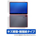 Magic Drawing Pad 表面 背面 フィルム OverLay Magic XPPen Android タブレット用保護フィルム 表面・背面セット 傷修復 耐指紋 指紋防止