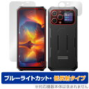 Blackview BL8000 表面 サブディスプレイ セット 保護 フィルム OverLay Eye Protector 低反射 スマホ用保護フィルム ブルーライトカット