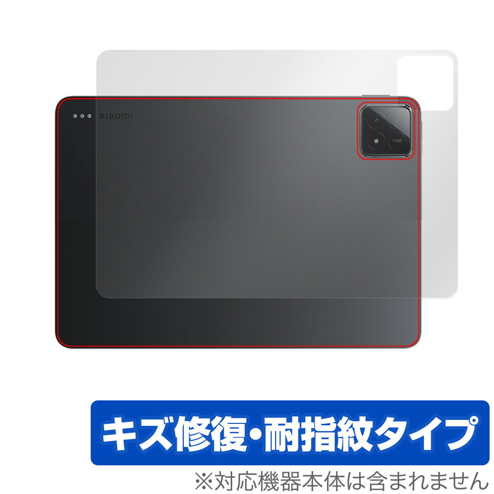 Xiaomi Pad 6s Pro 12.4 w ی tB OverLay Magic VI~[ ^ubgpیtB {̕ی C wh~ R[eBO