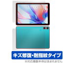 Teclast P30 表面 背面 フィルム OverLay Magic テクラスト タブレット用保護フィルム 表面・背面セット 傷修復 耐指紋 指紋防止