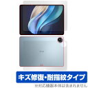 vivo Pad3 Pro 表面 背面 フィルム OverLay Magic ヴィーヴォ タブレット用保護フィルム 表面・背面セット 傷修復 耐指紋 指紋防止