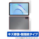 Plimpton P8 Pro 表面 背面 フィルム OverLay Magic プリンプトン タブレット用保護フィルム 表面・背面セット 傷修復 耐指紋 指紋...
