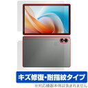 ALLDOCUBE iPlay 60 Lite 表面 背面 フィルム OverLay Magic for オールドキューブ タブレット 傷修復 耐指紋 指紋防止...